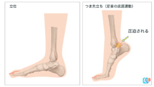 三角骨障害　底屈運動